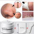 NOVO LANBENA Removedor de Cravos Máscara Peeling Facial Tira Poros Tratamento Acne Limpeza Profunda