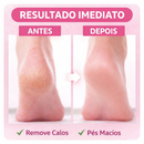 Pés Lisos em Minutos – Lixador de Pé Elétrico Removedor de Calos Profissional