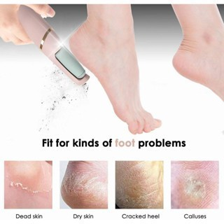 Pés Lisos em Minutos – Lixador de Pé Elétrico Removedor de Calos Profissional