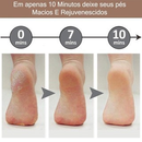 Pés Lisos em Minutos – Lixador de Pé Elétrico Removedor de Calos Profissional