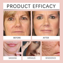 Máscara de Colágeno Noturna Coreana - Rejuvenesce, Hidrata e Ilumina! Aumenta a Elasticidade