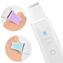 Raspador De Cravos Espátula Ultrasônica Limpeza Facial Remoção de Cravos Esfoliante