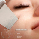 Raspador De Cravos Espátula Ultrasônica Limpeza Facial Remoção de Cravos Esfoliante